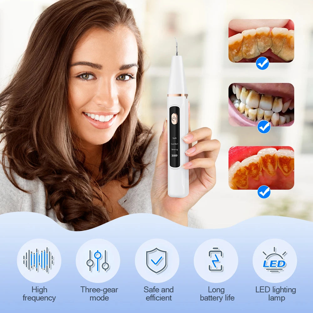 Sourire Clean — Détartreur dentaire à ultrasons
